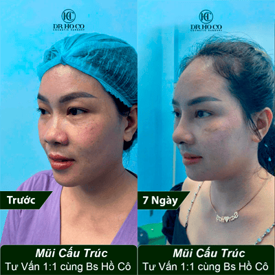 Slider image (1) Dr. Ho Co - Aesthetics and Plastic Surgery in Vietnam